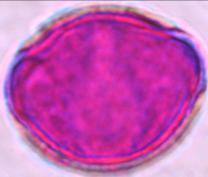 xalapensis